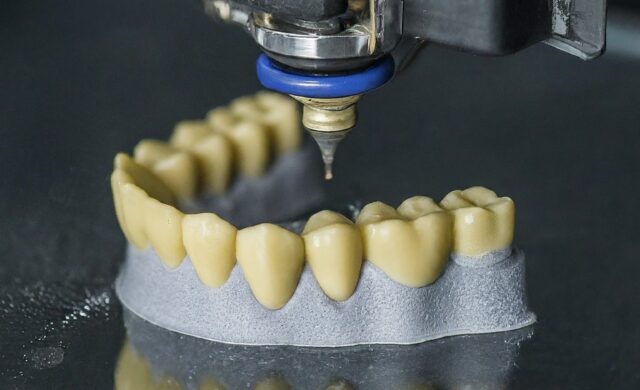 Revolutionizing Dental Care: The Magic of 3D Printing